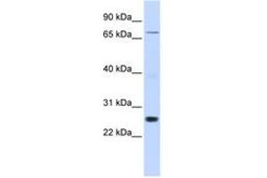 Image no. 1 for anti-Zinc Finger Protein 267 (ZNF267) (AA 288-337) antibody (ABIN6742593) (ZNF267 Antikörper  (AA 288-337))