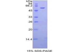 SDS-PAGE analysis of Rat Angiotensinogen Protein. (AGT Protein)