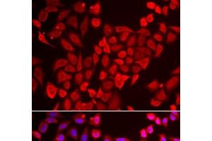 Immunofluorescence analysis of U2OS cells using TNP2 Polyclonal Antibody (TNP2 Antikörper)