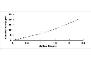 PTGDS ELISA Kit