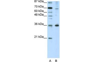 Western Blotting (WB) image for anti-Forkhead Box Q1 (FOXQ1) antibody (ABIN2461965) (FOXQ1 Antikörper)
