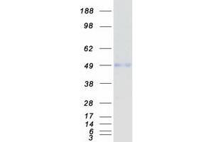 Western Blotting (WB) image for Nuclear Factor I/B (NFIB) protein (Myc-DYKDDDDK Tag) (ABIN2727223)