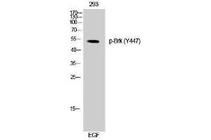 Western Blotting (WB) image for anti-PTK6 Protein tyrosine Kinase 6 (PTK6) (pTyr447) antibody (ABIN3173172) (PTK6 Antikörper  (pTyr447))