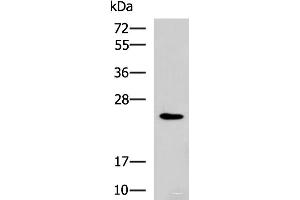 Western blot analysis of NIH/3T3 cell lysate using RAB38 Polyclonal Antibody at dilution of 1:900 (RAB38 Antikörper)