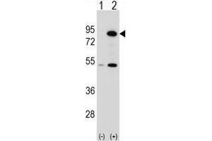 Western blot analysis of THOC1 (arrow) using rabbit polyclonal THOC1 Antibody (C-term) . (THOC1 Antikörper  (C-Term))