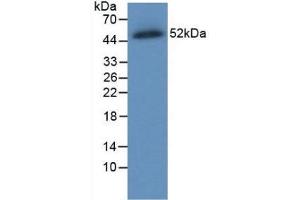 Western blot analysis of recombinant Human FPN. (SLC40A1 Antikörper  (AA 127-321))