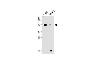 All lanes : Anti-B4GalT1 Antibody (C-term) at 1:1000 dilution Lane 1: Hela, whole cell lysate Lane 2: T47D whole cell lysate ysates/proteins at 20 μg per lane. (B4GALT1 Antikörper  (C-Term))