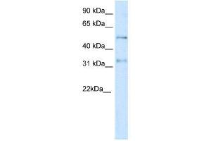 WB Suggested Anti-KCNAB2  Antibody Titration: 0. (KCNAB2 Antikörper  (Middle Region))