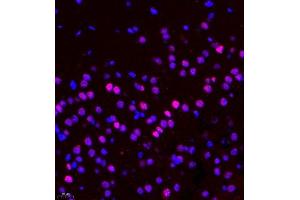 Immunofluorescence of paraffin embedded rat brain using CDY1 (ABIN7073493) at dilution of 1:400 (400x lens) (CDY1 Antikörper)