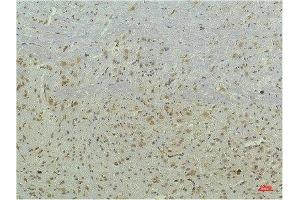 Immunohistochemical analysis of paraffin-embedded Mouse Brain Tissue using PPAR Delta Mouse mAb diluted at 1:200.