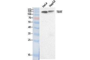Western Blotting (WB) image for anti-Telomerase Reverse Transcriptase (TERT) (Internal Region) antibody (ABIN3181058)