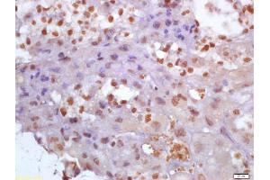 Formalin-fixed and paraffin embedded mouse placenta labeled with Anti-Glutamine PRPP amidotransferase Polyclonal Antibody, Unconjugated (ABIN872980) at 1:200 followed by conjugation to the secondary antibody and DAB staining