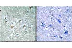 Immunohistochemistry analysis of paraffin-embedded human brain, using MLK1/2 (Phospho-Thr312/266) Antibody. (MLK1/2 Antikörper  (pThr312))