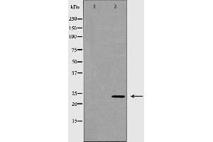 Western blot analysis of K562 cell lysate, using RAB27A Antibody. (RAB27A Antikörper  (C-Term))