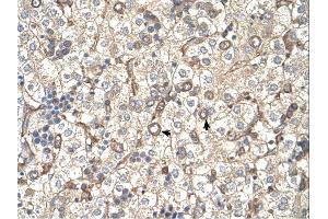 ST3GAL4 antibody was used for immunohistochemistry at a concentration of 4-8 ug/ml. (ST3GAL4 Antikörper  (Middle Region))