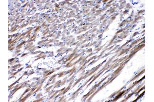Immunohistochemistry (IHC) image for anti-Cholinergic Receptor, Nicotinic, alpha 5 (Neuronal) (CHRNA5) (AA 44-76), (N-Term) antibody (ABIN5518749)