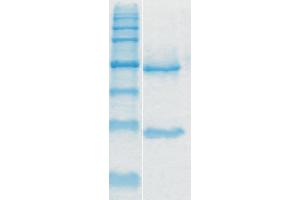 Image no. 1 for anti-Toxin A antibody (ABIN335169) (Toxin A Antikörper)