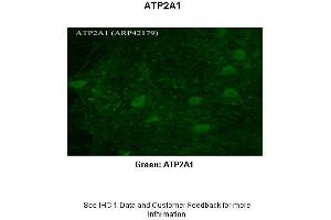Sample Type :  Rhesus macaque spinal cord  Primary Antibody Dilution :  1:300  Secondary Antibody :  Donkey anti Rabbit 488  Secondary Antibody Dilution :  1:500  Color/Signal Descriptions :  Green: ATP2A1  Gene Name :  ATP2A1  Submitted by :  Timur Mavlyutov, Ph. (ATP2A1/SERCA1 Antikörper  (N-Term))