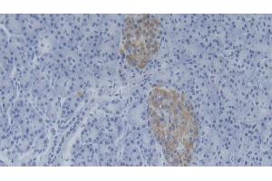 Detection of NMES1 in Human Pancreas Tissue using Polyclonal Antibody to Normal Mucosa Of Esophagus Specific 1 (NMES1) (NMES1 Antikörper  (AA 1-83))