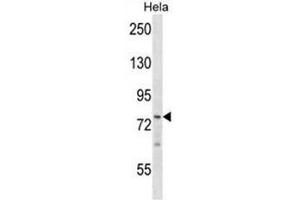 BRF1 Antibody (Center) western blot analysis in Hela cell line lysates (35µg/lane). (BRF1 Antikörper  (Middle Region))