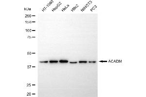 Western blotting analysis using ACADM antibody (ABIN7799351). (Rekombinanter Medium-Chain Specific Acyl-CoA Dehydrogenase, Mitochondrial (MCAD) Antikörper)