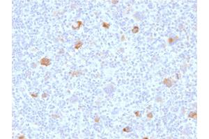Immunohistochemistry (IHC) image for anti-BCL2-Like 1 (BCL2L1) (AA 1-135) antibody (ABIN6940516) (BCL2L1 Antikörper  (AA 1-135))