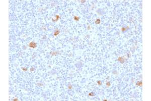 Immunohistochemistry (IHC) image for anti-BCL2-Like 1 (BCL2L1) (AA 1-135) antibody (ABIN6940516)