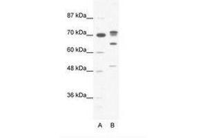 Image no. 1 for anti-DEAD (Asp-Glu-Ala-Asp) Box Polypeptide 21 (DDX21) (N-Term) antibody (ABIN6736053) (DDX21 Antikörper  (N-Term))