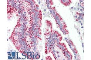 ABIN768615 (5µg/ml) staining of paraffin embedded Human Small Intestine. (SON Antikörper  (N-Term))
