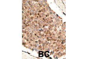 Immunohistochemistry (IHC) image for anti-Bone Morphogenetic Protein 10 (BMP10) antibody (ABIN5018806) (BMP10 Antikörper)