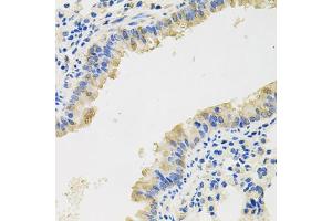 Immunohistochemistry of paraffin-embedded mouse lung using CXCL8 antibody (ABIN3172524) at dilution of 1/100 (40x lens). (IL-8 Antikörper)
