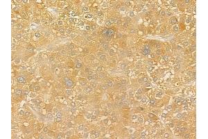 anti-Carboxypeptidase A (CPA) (Internal Region) antibody