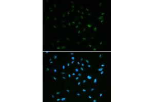 Immunofluorescence analysis of A549 cell using MSH6 antibody. (MSH6 Antikörper)