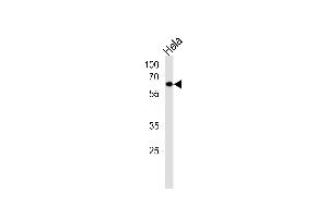 Western Blotting (WB) image for anti-Nuclear Receptor Subfamily 1, Group D, Member 2 (NR1D2) (AA 266-294) antibody (ABIN5531753)