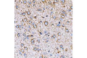 IHC analysis of RAB7/RAB7A using anti-RAB7/RAB7A antibody (ABIN7600597).