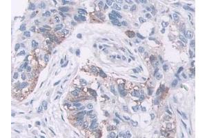 Immunohistochemistry (IHC) image for anti-NEL-Like 2 (Chicken) (NELL2) (AA 64-331) antibody (ABIN7430120)