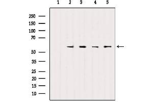 Western blot analysis of extracts from various samples, using SOX9 Antibody. (SOX9 Antikörper)