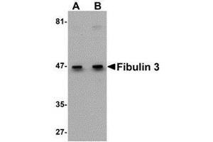 Western blot analysis of Fibulin 3 in HeLa cell lysate with AP30337PU-N Fibulin 3 antibody at (A) 0. (FBLN3 Antikörper  (C-Term))