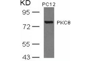 Image no. 3 for anti-Protein Kinase C, theta (PRKCQ) (AA 674-678) antibody (ABIN197566) (PKC theta Antikörper  (AA 674-678))