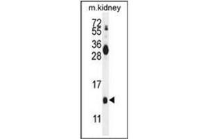 Western blot analysis of Midkine Antibody (C-term) in mouse kidney tissue lysates (35ug/lane).
