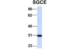 Western Blotting (WB) image for anti-Sarcoglycan, epsilon (SGCE) (N-Term) antibody (ABIN2782610)