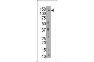 The anti-ABCB11 C-term Pab (ABIN390059 and ABIN2840586) is used in Western blot to detect ABCB11 in mouse liver tissue lysate. (ABCB11 Antikörper  (C-Term))