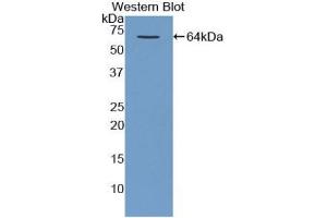 Detection of Recombinant MBP, Human using Polyclonal Antibody to Major Basic Protein (MBP) (Major Basic Protein Antikörper  (AA 105-222))
