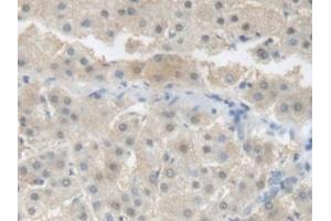 Detection of CRP in Human Liver Tissue using Polyclonal Antibody to C Reactive Protein (CRP) (CRP Antikörper  (AA 17-224))