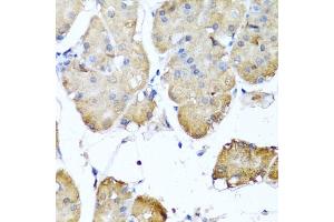 Immunohistochemistry of paraffin-embedded human stomach using NIN antibody (ABIN6129422, ABIN6144630, ABIN6144632 and ABIN6224239) at dilution of 1:100 (40x lens). (Ninein Antikörper  (AA 1-287))