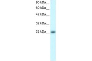 Western Blotting (WB) image for anti-MAX Dimerization Protein 4 (MXD4) antibody (ABIN2460569) (MXD4 Antikörper)
