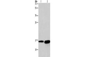 Gel: 12 % SDS-PAGE, Lysate: 40 μg, Lane 1-2: Mouse heart tissue, human hepatocellular carcinoma tissue, Primary antibody: ABIN7129699(HINT2 Antibody) at dilution 1/300, Secondary antibody: Goat anti rabbit IgG at 1/8000 dilution, Exposure time: 20 seconds (HINT2 Antikörper)