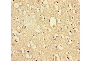 Immunohistochemistry of paraffin-embedded human brain tissue using ABIN7164380 at dilution of 1:100 (DHX35 Antikörper  (AA 1-300))