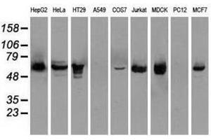 Image no. 3 for anti-Checkpoint Kinase 2 (CHEK2) antibody (ABIN1497500) (CHEK2 Antikörper)