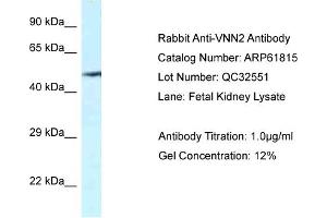 Western Blotting (WB) image for anti-Vanin 2 (VNN2) (C-Term) antibody (ABIN2788913) (VNN2 Antikörper  (C-Term))